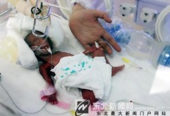 怀孕26周胎儿图片（26周孩子有多少斤）