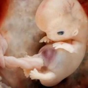 6个月宝宝肚子咕噜响，是怎么回事？宝宝的肚子总是在咕噜咕,6个月的胎儿图片 真实