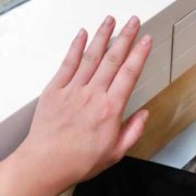 孕期手肿（孕期手肿胀握拳有紧绷感觉）