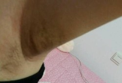 孕期腋下肿大（孕期腋下肿大是怎么回事）