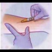 怀孕期间能做吗（结核菌素试验怀孕期间能做吗）