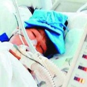胎儿死图片（人为什么都要死呢？如果早晚都会死，那活着还有什么意义呢）