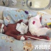 一斤重的胎儿图（一斤重的胎儿图）
