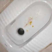 孕妇呕吐出血是怎么回事,孕期经期出血怎么回事