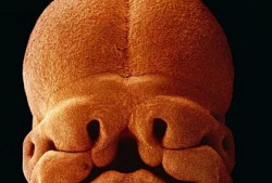 21周胎儿视频（怀孕二十周胎儿有多大？大家知道吗）