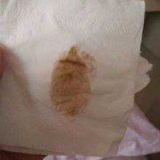 有褐色分泌物都会胎停的吗，这样是不是很危险的呢,