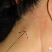 孕期淋巴发炎（孕期淋巴发炎对胎儿有影响吗）