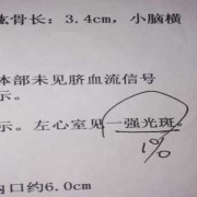 多少孕妇有胎儿强光斑（左心室强光斑最坏结果）