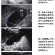 怀孕３３周打彩超时胎儿的胆囊显示不清是怎么回事,为什么,胎儿胆囊充盈差是什么原因