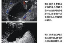 怀孕３３周打彩超时胎儿的胆囊显示不清是怎么回事,为什么,胎儿胆囊充盈差是什么原因