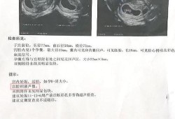 怀孕了但是有积液，怎么办,胎儿有积液对胎儿有什么影响呢?