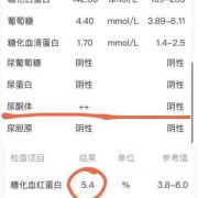 尿酮体对胎儿的影响（孕12尿检尿酮体2+，是怎么回事？应注意什么）