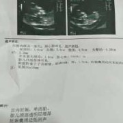 胎儿颈部透明多少钱（胎儿颈后透明层厚度的正常值是是多少）