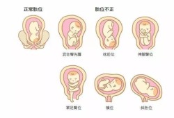 胎儿臂位（胎儿臂位）