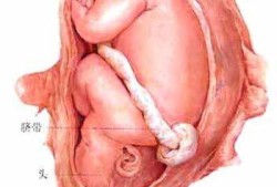 怀孕26周胎儿大小多少算是正常？请问正常的情况胎儿多大呢,怀孕26周胎儿图片真实