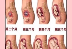 孕期子宫变化（孕期子宫变化过程）