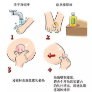 怀孕期间乳头分泌物（怀孕期间乳头分泌物用清理吗）