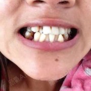 胎儿埋在哪比较合适（俗话说上牙掉了扔房顶,下牙掉了扔哪里）