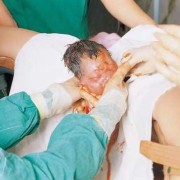顺产产妇第一次大便方法,胎儿怎么拉屎撒尿