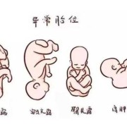 胎儿为什么胎位不正（胎儿为什么胎位不正呢）