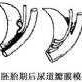 孕中期总感觉胎动已到尿道口是为什么,胎儿后尿道瓣膜是什么原因造成的