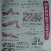 胎儿一直臀位什么原因，要怎么可以调整过来,胎儿臀位是啥意思