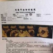胎儿三级检查（胎儿三级筛查是大排畸吗）