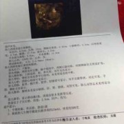 常规胎儿（常规胎儿超声检查）