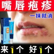 孕期嘴巴上火起泡怎么办（上火嘴唇起泡吃什么药好）