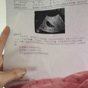 怀孕有9周了，产检结果见微弱原始心管搏动，这是什么意思,怀孕第九周胎儿发育图