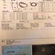 胎儿为什么会偏大（胎儿偏大一周是什么原因）