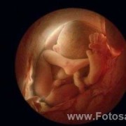 怀孕35周胎儿生下来是什么样的呢,怀孕35周胎儿发育情况