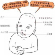 胎儿乙醇综合征（胎儿乙醇综合征）