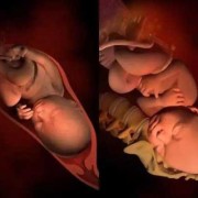 宝宝在肚子里背着妈妈是怎么回事,胎儿在肚子里的姿势图片
