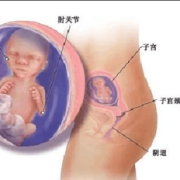 孕期17周（17周胎儿在肚子的位置是哪里呢？上面还是下面呢）