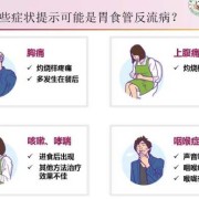 孕期食管返流（食道反流怎么治疗）