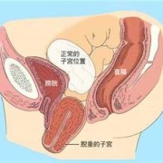 孕期子宫下垂能顺产吗（孕期子宫下垂能顺产吗有危险吗）