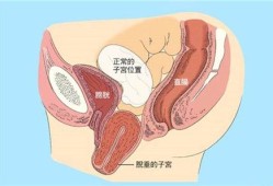 孕期子宫下垂能顺产吗（孕期子宫下垂能顺产吗有危险吗）