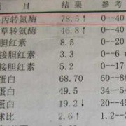 孕期谷丙转氨酶高（孕妇谷丙转氨酶偏高吃什么）