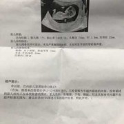 胎儿签定（胎儿签定男孩女孩要多久才有结果单）