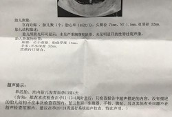 胎儿签定（胎儿签定男孩女孩要多久才有结果单）