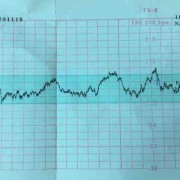 38周胎儿胎心多少正常（怀孕38周胎心监护180是正常的吗，小孩子的胎心是孕妇的心跳影响的吗）