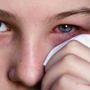 孕妇眼睛痒怎么办,孕期眼角干痒怎么回事