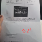 怀孕8周胎儿图片尺寸（怀孕8周胎心177正常吗）
