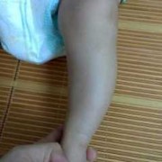 胎儿腿长说明什么（17个月宝宝腿多长是正常的）