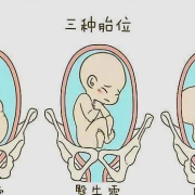 胎儿趴着的原因（胎儿趴着的原因有哪些）