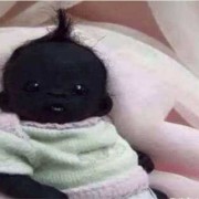 宝宝皮肤黑怎么办,胎儿黑是什么原因
