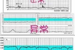 胎儿的心率是多少正常范围,胎儿没有心跳是什么原因造成的