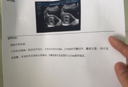 胎儿左侧侧脑室（胎儿一侧侧脑室见宽约0,6cm液性暗区意味着什么）