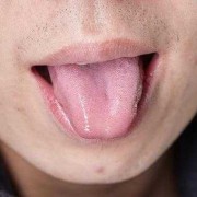 孕期舌头发麻是怎么回事,孕期脸部发麻怎么回事